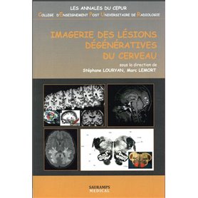 IMAGERIE DES LESIONS DEGENERATIVES DU CERVEAU