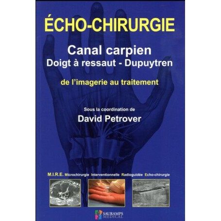 ECHO-CHIRURGIE CANAL CARPIEN, DOIGT A RESSAUT ET DUPUYTREN