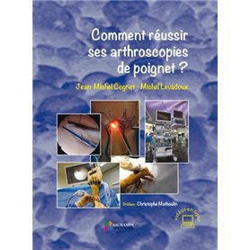 COMMENT REUSSIR SES ARTHROSCOPIES DE POIGNET ?