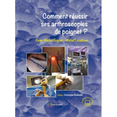 COMMENT REUSSIR SES ARTHROSCOPIES DE POIGNET ?