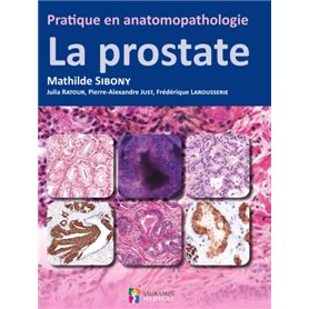 PRATIQUE EN ANATOMOPATHOLOGIE - LA PROSTATE