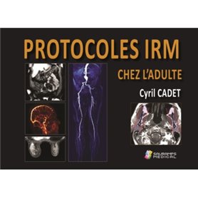 PROTOCOLES IRM CHEZ L ADULTE