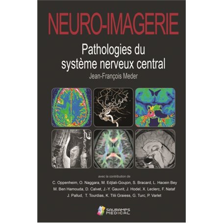 NEURO-IMAGERIE. PATHOLOGIES DU SYSTEME NERVEUX CENTRAL 2ED