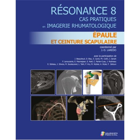 RESONANCE 8 - EPAULE ET CEINTURE SCRAPULAIRE