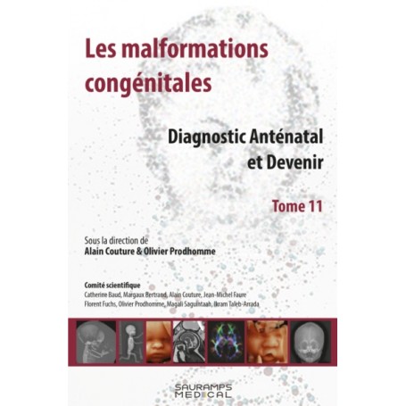 LES MALFORMATIONS CONGENITALES T.11-DIAGNOSTIC ANTENATAL ET DEVENIR