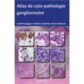 ATLAS DE CYTOPATHOLOGIE GANGLIONNAIRE