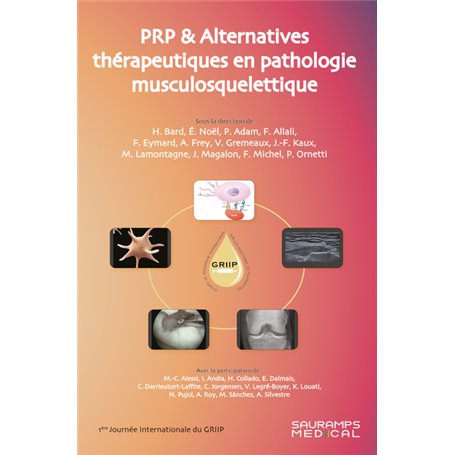 PRP & Alternatives thérapeutiques en pathologie musculosquelletique