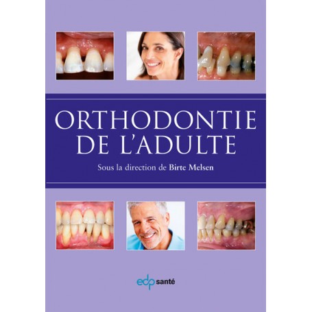 Orthodontie de l'adulte