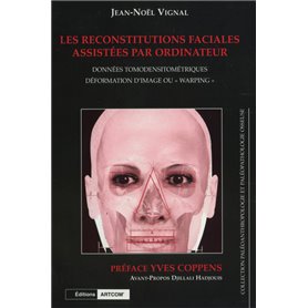 Les Reconstitutions Faciales Assistées Par Ordinateur