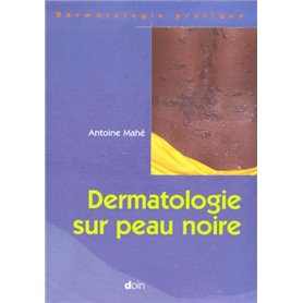 Dermatologie sur peau noire