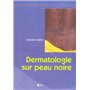 Dermatologie sur peau noire