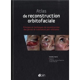 Atlas de reconstruction orbitofaciale