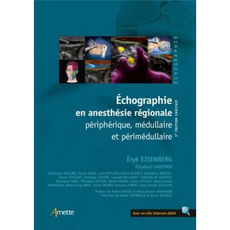 Echographie en anesthésie régionale