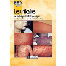 Les Urticaires-De La Clinique A La Therapeutique