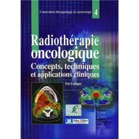 La radiothérapie oncologique