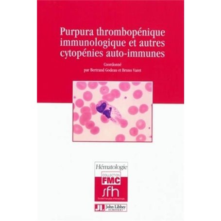 Purpura thrombopénique immunologique et autres cytopénies auto-immunes