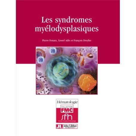 Les syndromes myélodysplasiques