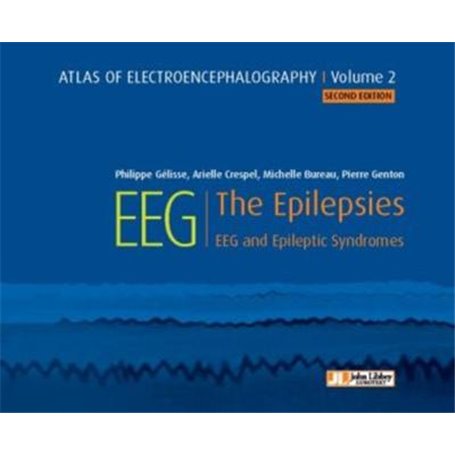 Atlas of electroencephalography - Volume 2
