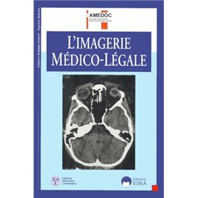 IMAGERIE MEDICOLEGALE