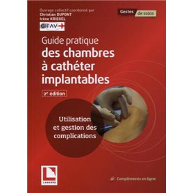 Guide pratique des chambres à cathéter implantables