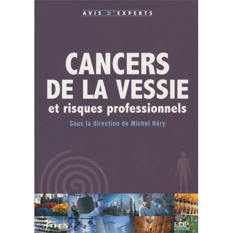 cancers de la vessie et risque professionnels