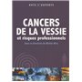 cancers de la vessie et risque professionnels