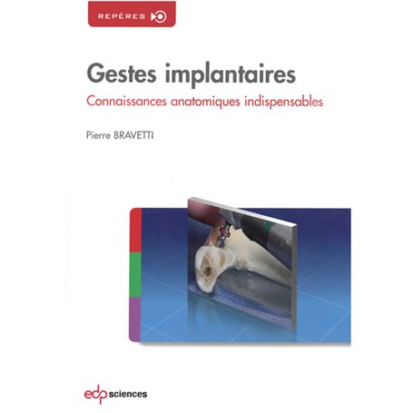 GESTES IMPLANTAIRES,CONNAISSANCES ANATOMIQUES INDISPENSABLES