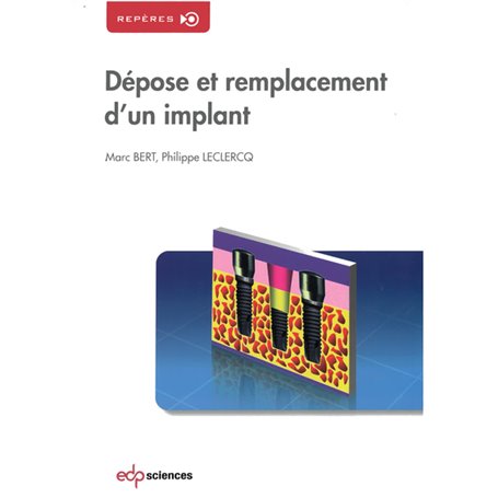 DEPOSE ET REMPLACEMENT D'UN IMPLANT