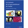 Les tumeurs de la loge postérieure de l'orbite - Tome 2