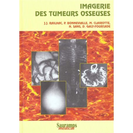 IMAGERIE DES TUMEURS OSSEUSES