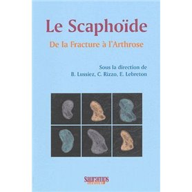 LE SCAPHOIDE