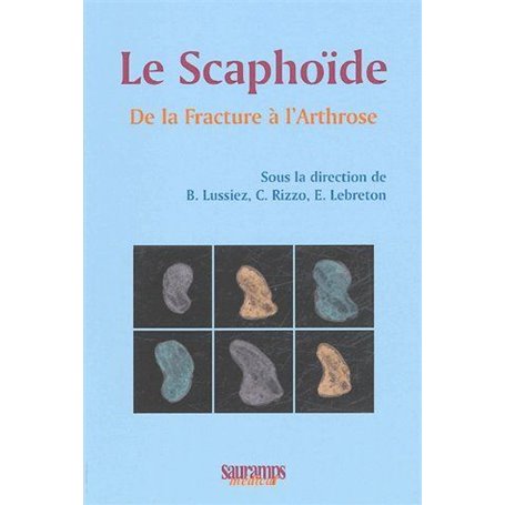 LE SCAPHOIDE