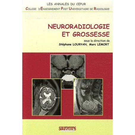 NEURORADIOLOGIE ET GROSSESSE