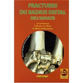 FRACTURES DU RADIUS DISTAL DE L ADULTE