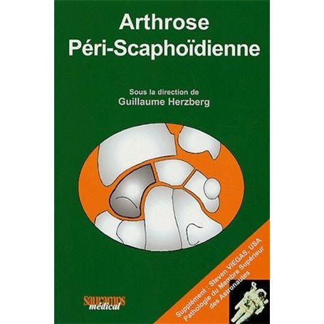 ARTHROSE PERI SCAPHOIDIENNE