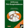 ARTHROSE PERI SCAPHOIDIENNE