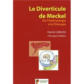 LE DIVERTICULE DE MECKEL