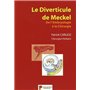 LE DIVERTICULE DE MECKEL