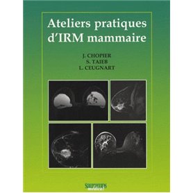 ATELIERS PRATIQUES D IRM MAMMAIRE