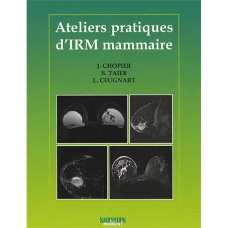 ATELIERS PRATIQUES D IRM MAMMAIRE