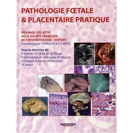 PATHOLOGIE FOETALE ET PLACENTAIRE PRATIQUE