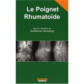 LE POIGNET RHUMATOIDE