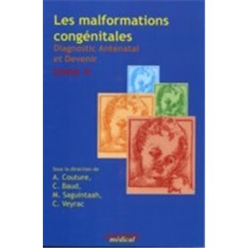 LES MALFORMATIONS CONGENITALES T.4 DIAGNOSTIC ANTENATAL ET DEVENIR