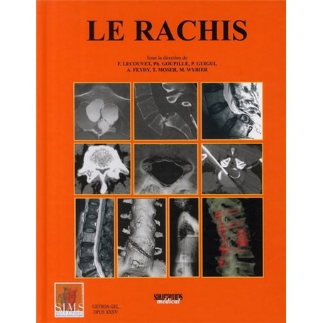 LE RACHIS SIMS