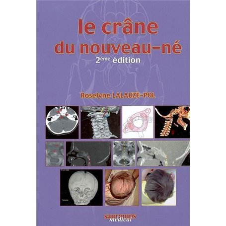 LE CRANE DU NOUVEAU NE 2E ED