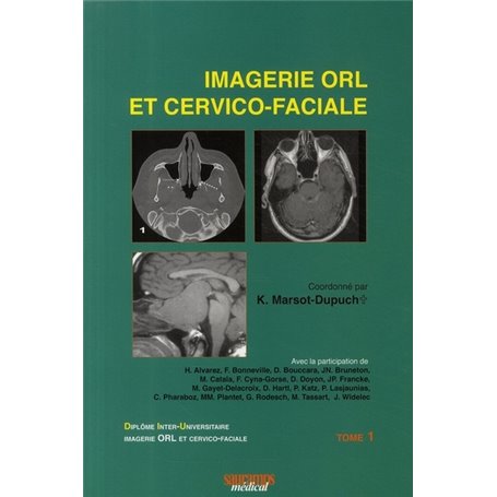 IMAGERIE ORL ET CERVICO FACIALE T1 3 ED