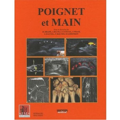 POIGNET ET MAIN SIMS