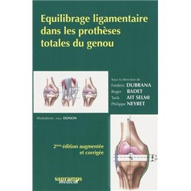 EQUILIBRAGE LIGAMENTAIRE DE LA PROTHESE DU GENOU 2?ED REVUE ET COMPLETEE