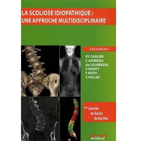 LA SCOLIOSE IDIOPATHIQUE APPROCHE MULTIDISCIPLINAIRE