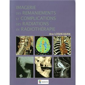 IMAGERIE DES RAMANIEMENTS ET COMPLICATIONS DES RADIATIONS EN RADIOTHERAPIE